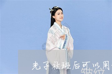 光子祛斑后可以用卸妆水吗