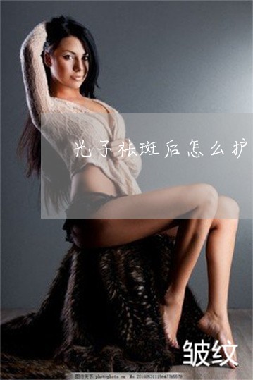 光子祛斑后怎么护理 光子祛斑后怎么护理