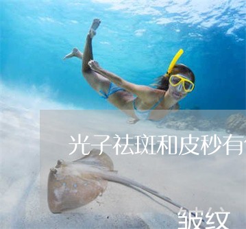 光子祛斑和皮秒有什么区别 光子祛斑和皮秒有什么区别