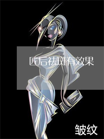 匠后祛斑有效果 匠后祛斑有效果