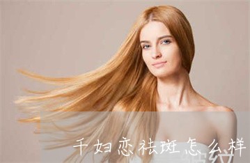 千妇恋祛斑怎么样