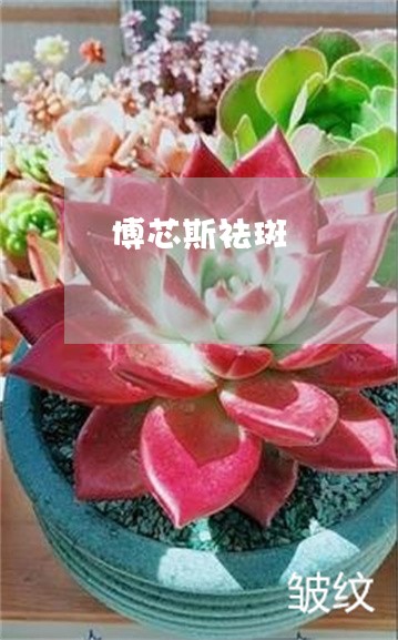 博芯斯祛斑