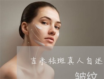 吉米祛斑真人自述 吉米祛斑真人自述