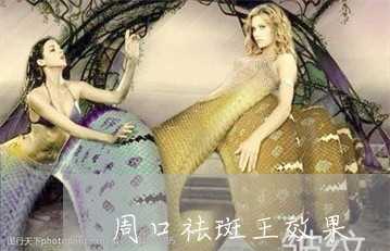 周口祛斑王效果 周口祛斑王效果