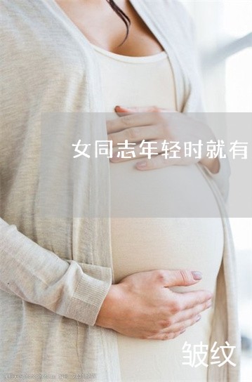 女同志年轻时就有法令纹