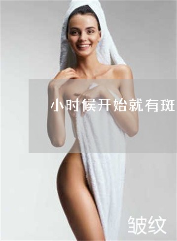 小时候开始就有斑如何祛斑