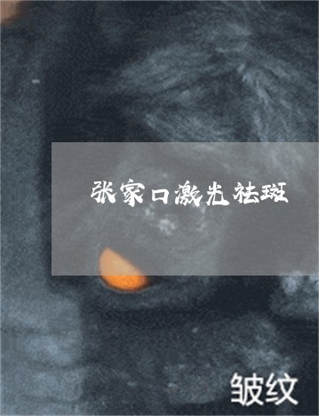 张家口激光祛斑 张家口激光祛斑