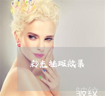 彩光祛斑效果 彩光祛斑效果