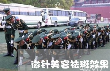 微针美容祛斑效果 微针美容祛斑效果