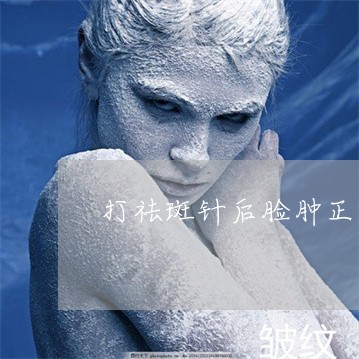 打祛斑针后脸肿正常吗 打祛斑针后脸肿正常吗
