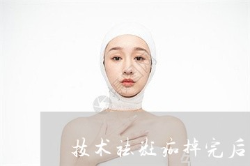 技术祛斑痂掉完后可以喝啤酒吗 技术祛斑痂掉完后可以喝啤酒吗