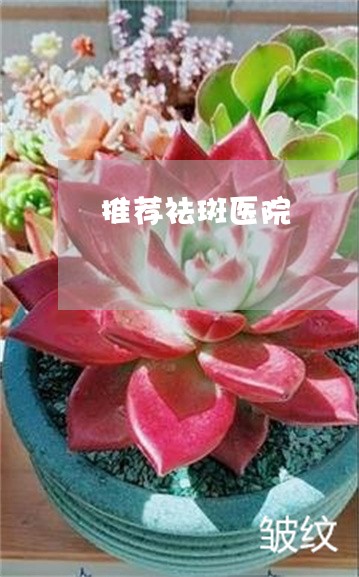 推荐祛斑医院