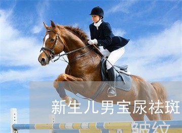 新生儿男宝尿祛斑吗 新生儿男宝尿祛斑吗