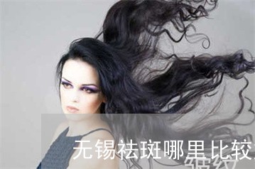 无锡祛斑哪里比较好 无锡祛斑哪里比较好