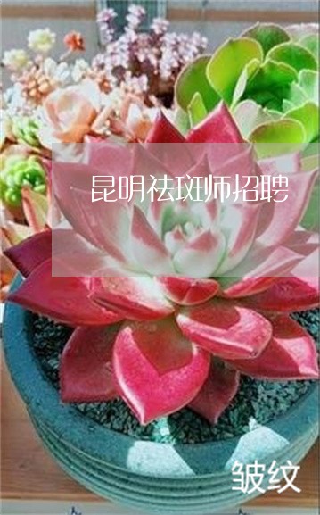 昆明祛斑师招聘