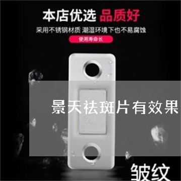 景天祛斑片有效果吗 景天祛斑片有效果吗