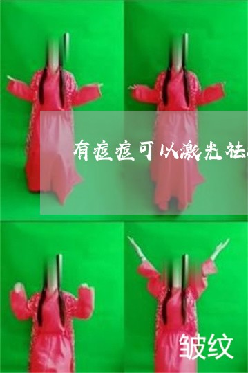有痘痘可以激光祛斑吗 有痘痘可以激光祛斑吗