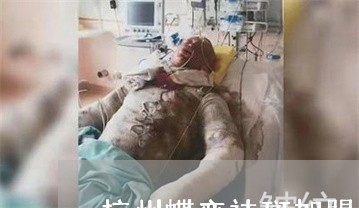 杭州蝶变祛斑加盟 杭州蝶变祛斑加盟