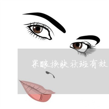 果酸换肤祛斑有效果吗 果酸换肤祛斑有效果吗