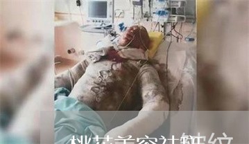 桃花美容祛斑