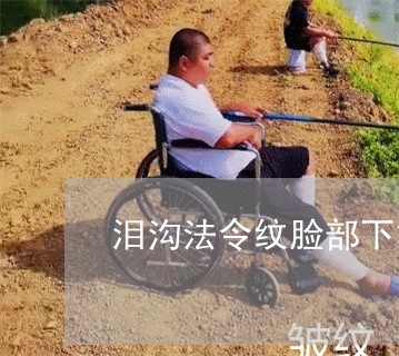 泪沟法令纹脸部下垂的厉害