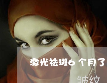 激光祛斑6个月了还反黑 激光祛斑6个月了还反黑