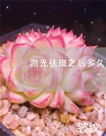 激光祛斑之后多久可以涂护肤品 激光祛斑之后多久可以涂护肤品