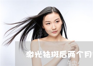 激光祛斑后两个月脸上斑又出来了 激光祛斑后两个月脸上斑又出来了