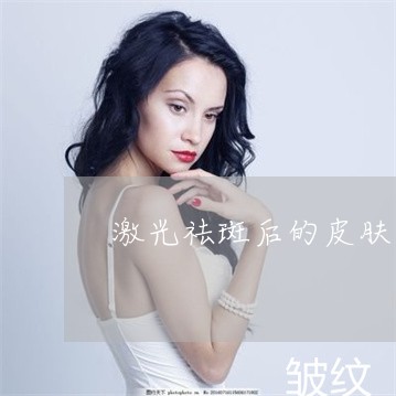 激光祛斑后的皮肤黑 激光祛斑后的皮肤黑