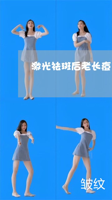 激光祛斑后老长痘