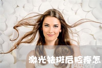激光祛斑后脸疼怎么办 激光祛斑后脸疼怎么办