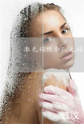 激光祛斑和E光祛斑的区别 激光祛斑和E光祛斑的区别