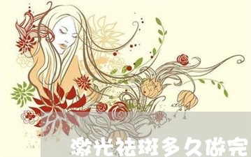 激光祛斑多久做完