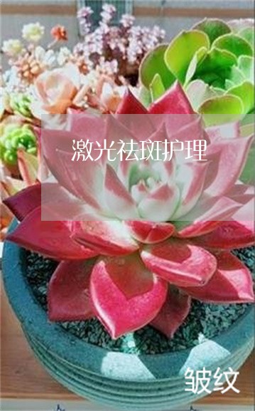 激光祛斑护理