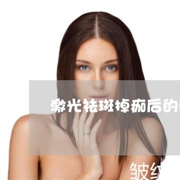 激光祛斑掉痂后的防护 激光祛斑掉痂后的防护