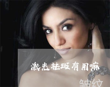 激光祛斑有用嘛