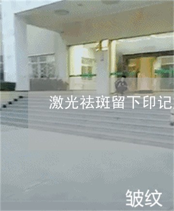 激光祛斑留下印记好久没有好 激光祛斑留下印记好久没有好
