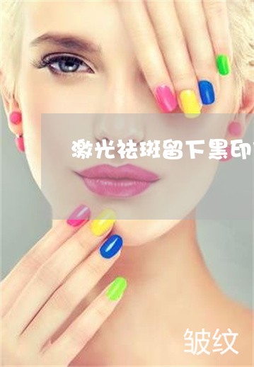 激光祛斑留下黑印什么时候能好 激光祛斑留下黑印什么时候能好