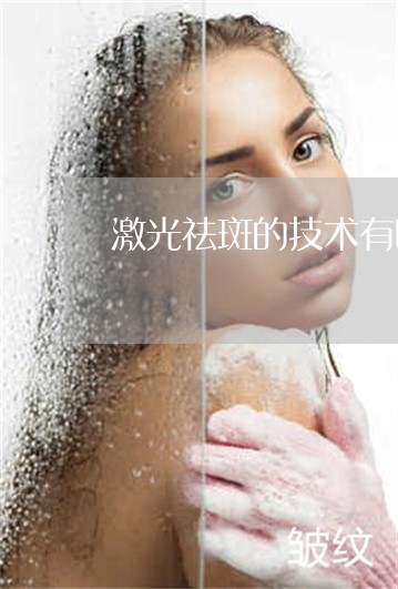 激光祛斑的技术有哪些