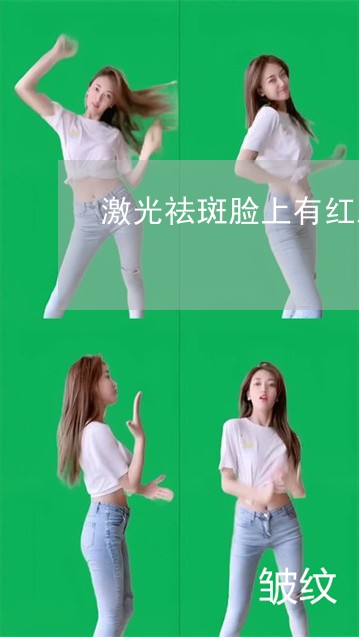 激光祛斑脸上有红血丝 激光祛斑脸上有红血丝