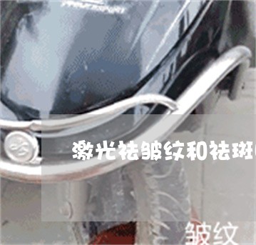 激光祛皱纹和祛斑哪个效果好 激光祛皱纹和祛斑哪个效果好