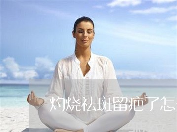 灼烧祛斑留疤了怎么办 灼烧祛斑留疤了怎么办