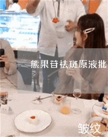 熊果苷祛斑原液批发厂家 熊果苷祛斑原液批发厂家