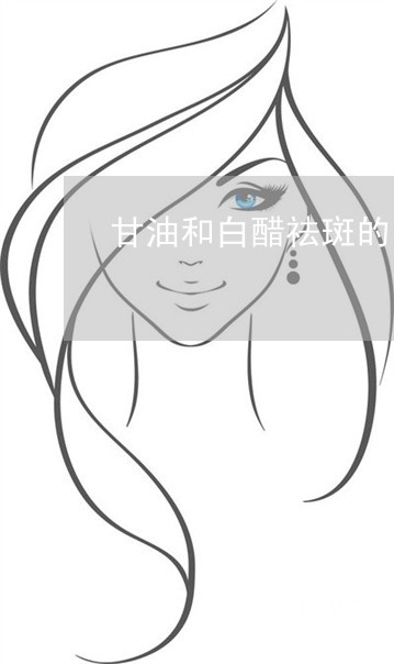 甘油和白醋祛斑的比例 甘油和白醋祛斑的比例