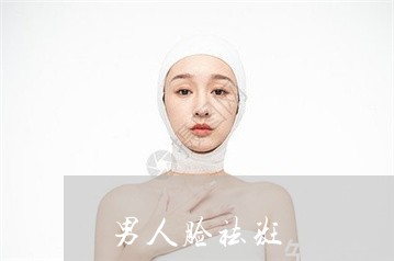 男人脸祛斑