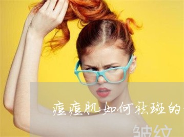 痘痘肌如何祛斑的方法 痘痘肌如何祛斑的方法