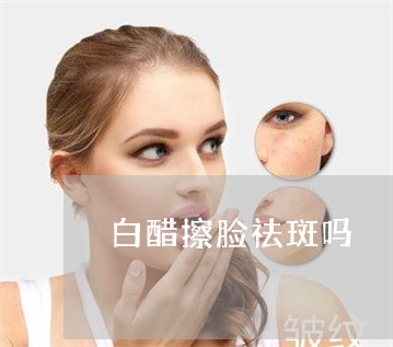 白醋擦脸祛斑吗 白醋擦脸祛斑吗