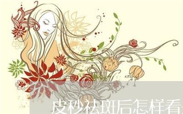 皮秒祛斑后怎样看是否结痂