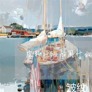 皮秒祛斑后用什么化妆品最好 皮秒祛斑后用什么化妆品最好