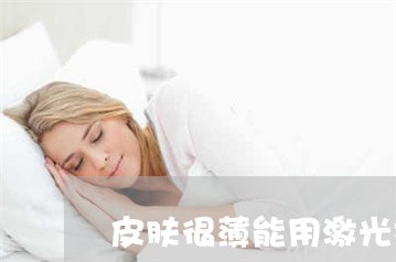 皮肤很薄能用激光祛斑吗